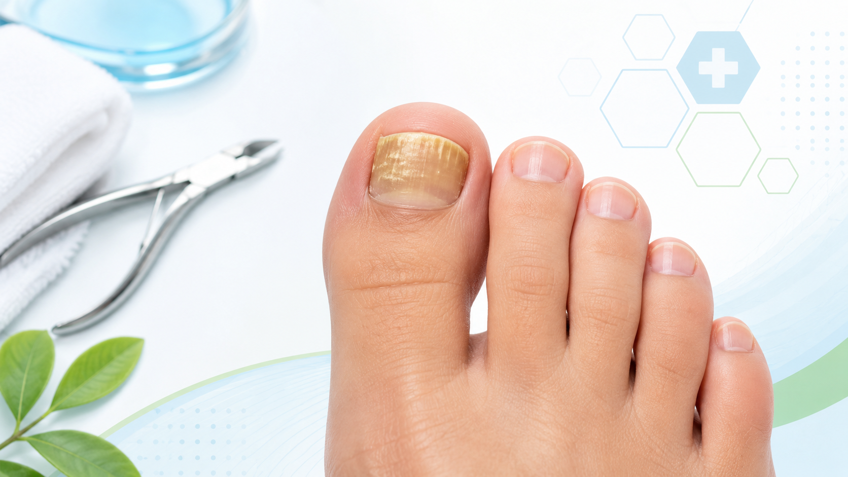 nail fungus symptoms on toenail